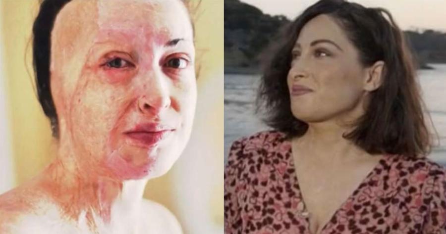 Ιωάννα Παλιοσπύρου: Μίλησε για τις δραματικές στιγμές της επίθεσης και έδειξε για πρώτη φορά το πρόσωπο της