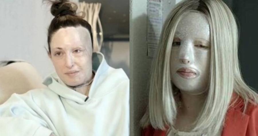 «Έβλεπα τα μαλλιά μου να πέφτουν στον νιπτήρα»: Η συγκλονιστική εξομολόγηση της Ιωάννας Παλιοσπύρου περιγράφοντας τις δραματικές στιγμές που πέρασε