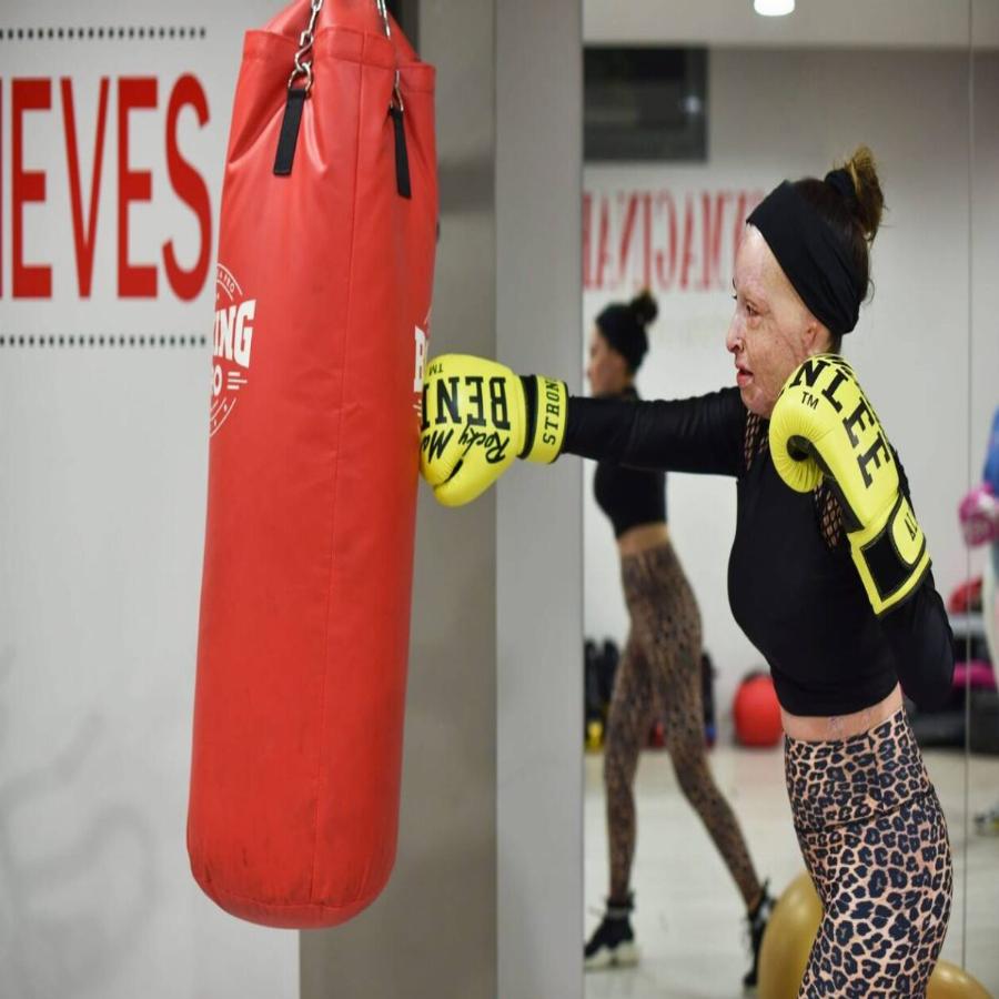 Ιωάννα Παλιοσπύρου: Η νέα της ζωή, η τεράστια δύναμη ψυχής, η τηλεοπτική εμφάνιση και οι νέες φωτογραφίες