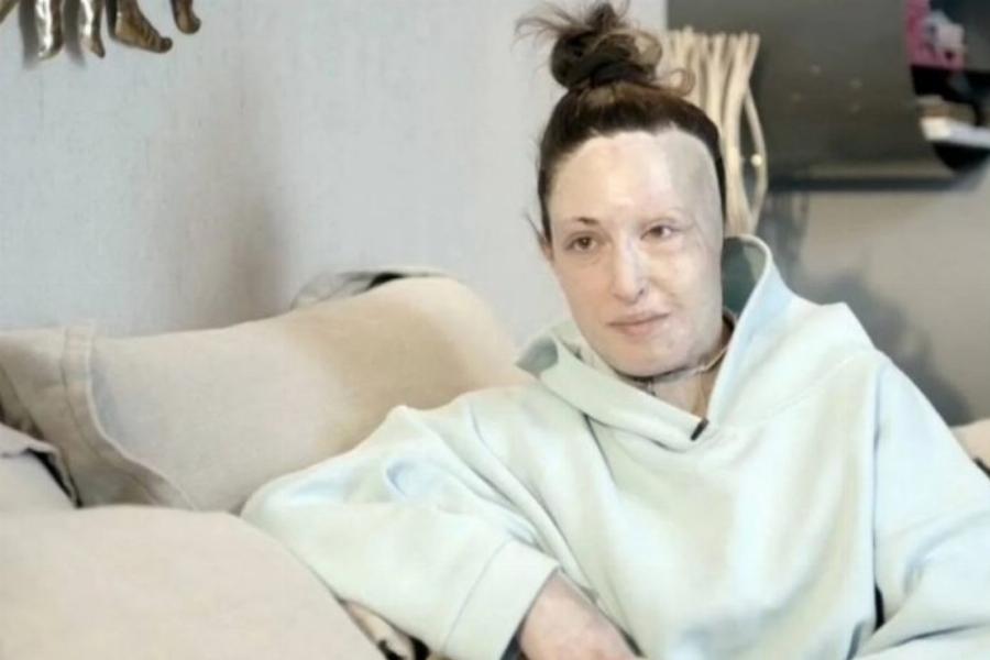 «Τους πρώτους μήνες δεν ήθελα καν να με ακουμπάω»: Η Ιωάννα Παλιοσπύρου χωρίς την μάσκα