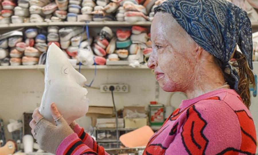 Ιωάννα Παλιοσπύρου: Μίλησε για τις δραματικές στιγμές της επίθεσης και έδειξε για πρώτη φορά το πρόσωπο της