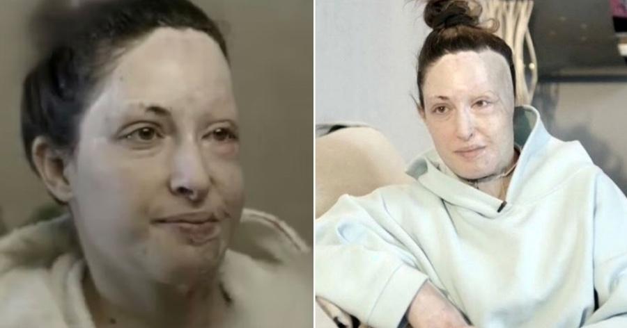 Ιωάννα Παλιοσπύρου: Συγκλόνισε με την δύναμη της, βγάζοντας για πρώτη φορά την μάσκα της