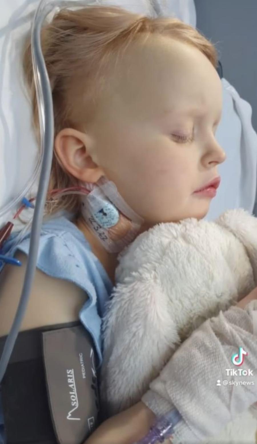 3χρονο κοριτσάκι: Παραλίγο να χάσει την ζωή της από ηπατίτιδα