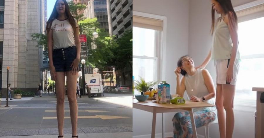 Μογγολία: 29χρονη έχει τα δεύτερα μακρύτερα πόδια στον κόσμο και εξηγεί πόσο δύσκολη είναι η ζωή της