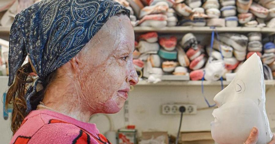 «Πρότυπα σαν και εσένα θέλουμε!»: Πανελλήνια υπόκλιση στην Ιωάννα Παλιοσπύρου που έδειξε το πρόσωπό της