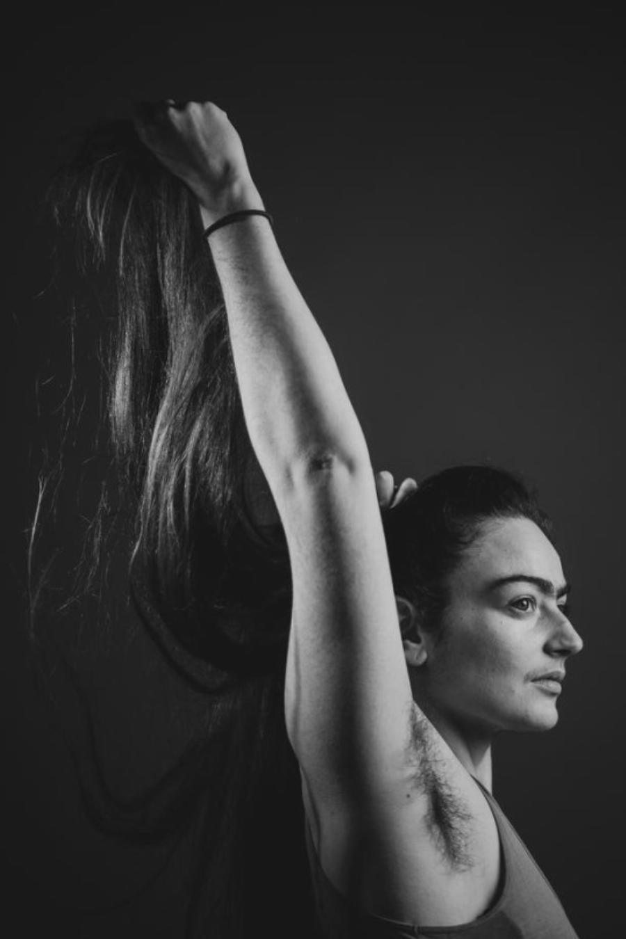 Κοπεγχάγη: Η 31χρονη σταμάτησε να βγάζει φρύδια και μουστάκι –  Νιώθει θηλυκή ακόμη και με τις τρίχες της