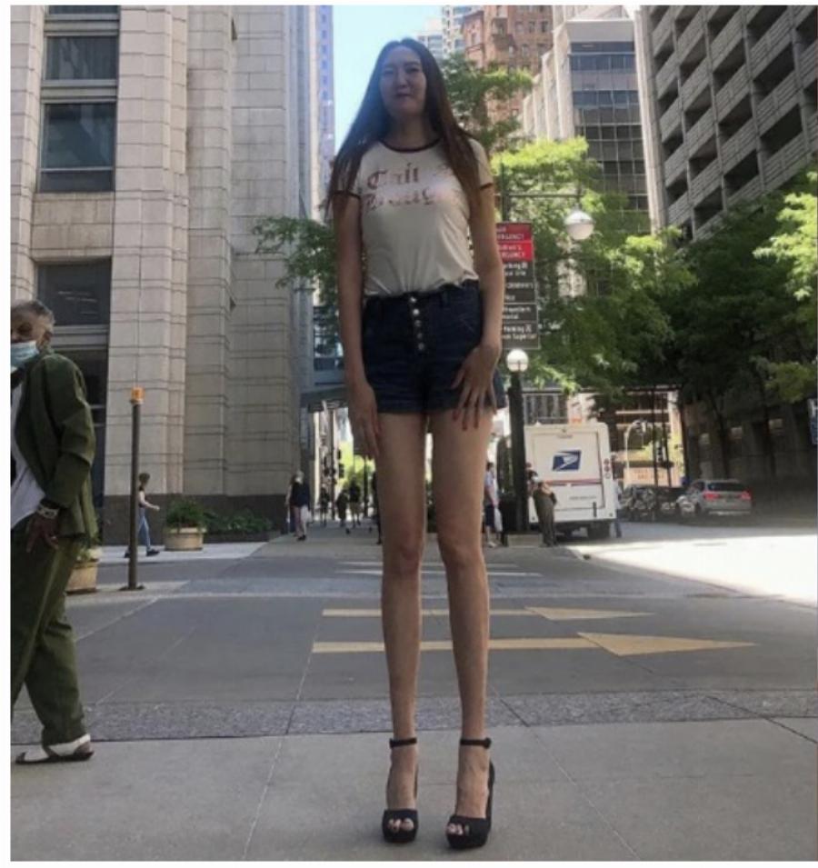 Μογγολία: 29χρονη έχει τα δεύτερα μακρύτερα πόδια στον κόσμο και εξηγεί πόσο δύσκολη είναι η ζωή της