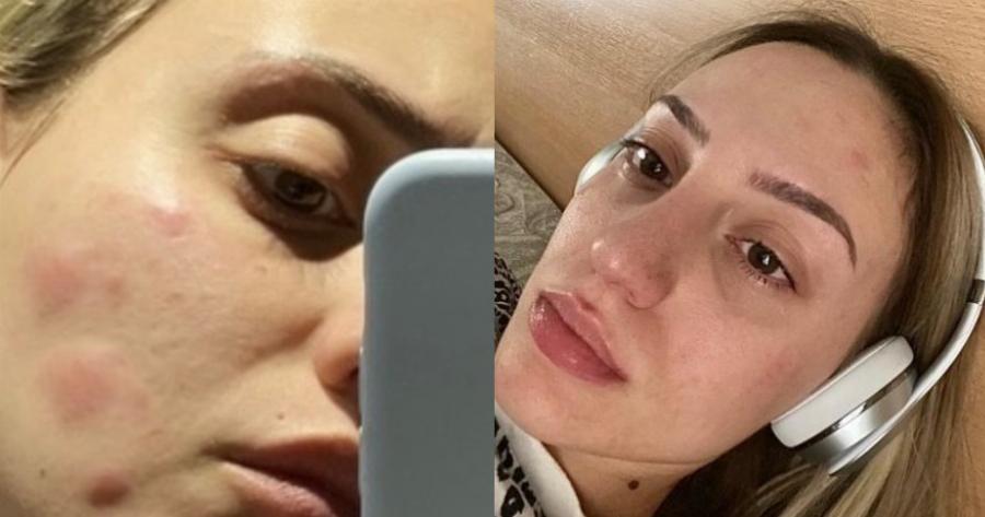 «Υποφέρω από καταθλιπτικά επεισόδια»: Η ανάρτηση της Άννας Κορακάκη για τον μανιακό που την παρακολουθούσε