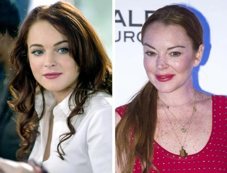 Άλλαξαν ριζικά από τις πλαστικές: 10 περιπτώσεις που καταστράφηκαν από την ματαιοδοξία τους και το νυστέρι