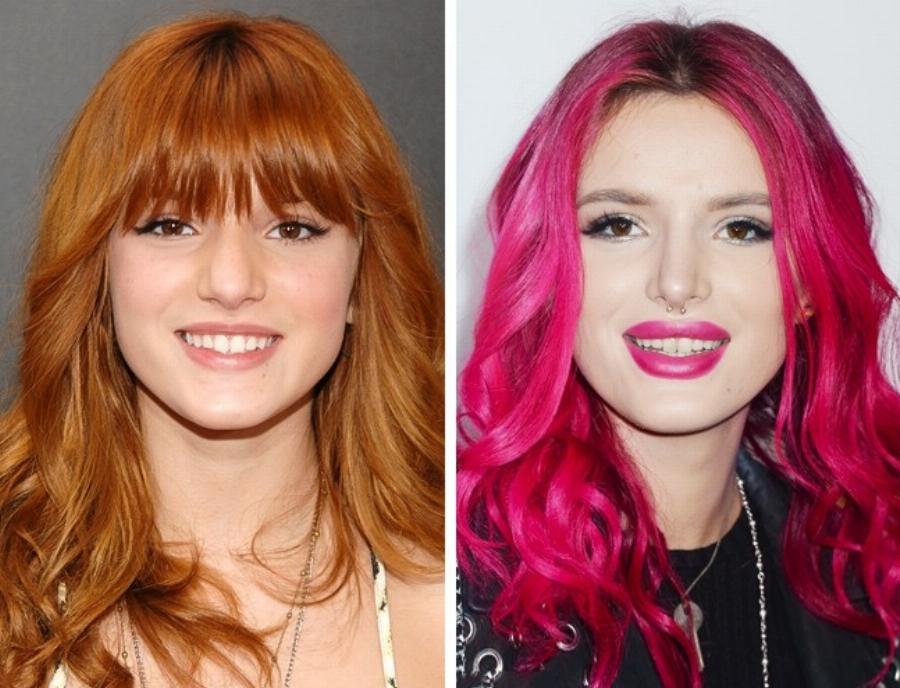 Άλλαξαν ριζικά από τις πλαστικές: 10 περιπτώσεις που καταστράφηκαν από την ματαιοδοξία τους και το νυστέρι