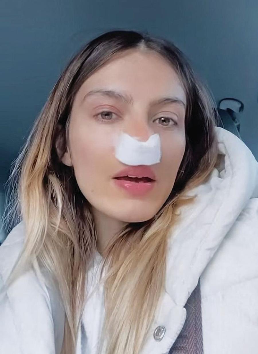 Έφτιαξε τη μύτη και έγινε μια θεά: Η Ασημίνα από το Masterchef θα έκανε φέτος και την Καγιά να της υποκλιθεί