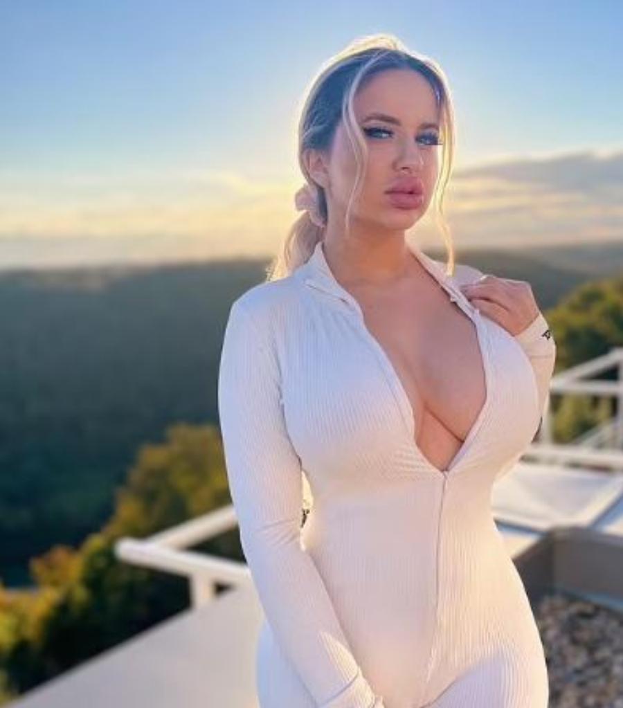 21χρονη: Ξόδεψε 65.000 ευρώ σε πλαστικές επεμβάσεις προκειμένου να μοιάζει σαν την Barbie