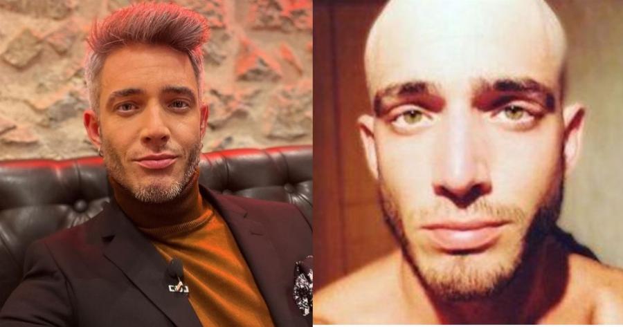 Θεοχάρης Ιωαννίδης: «Σε ένα βράδυ μου έφυγαν όλα τα μαλλιά»