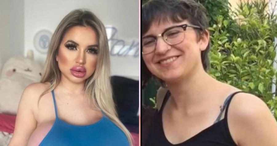 21χρονη: Ξόδεψε 65.000 ευρώ σε πλαστικές επεμβάσεις προκειμένου να μοιάζει σαν την Barbie