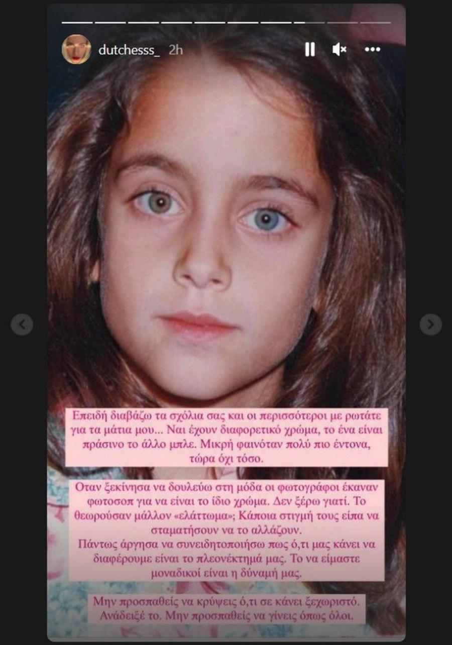 Δούκισσα Νομικού: Το γνωστό μοντέλο δείχνει τα μάτια της που έχουν διαφορετικό χρώμα