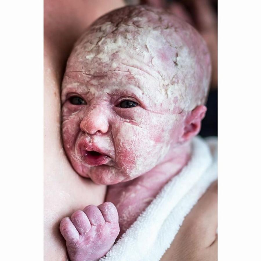 Μωρό γεννήθηκε γεμάτο μαλλιά και με μεγάλο χαμόγελο και οι φωτογραφίες του κάνουν το γύρο του διαδικτύου