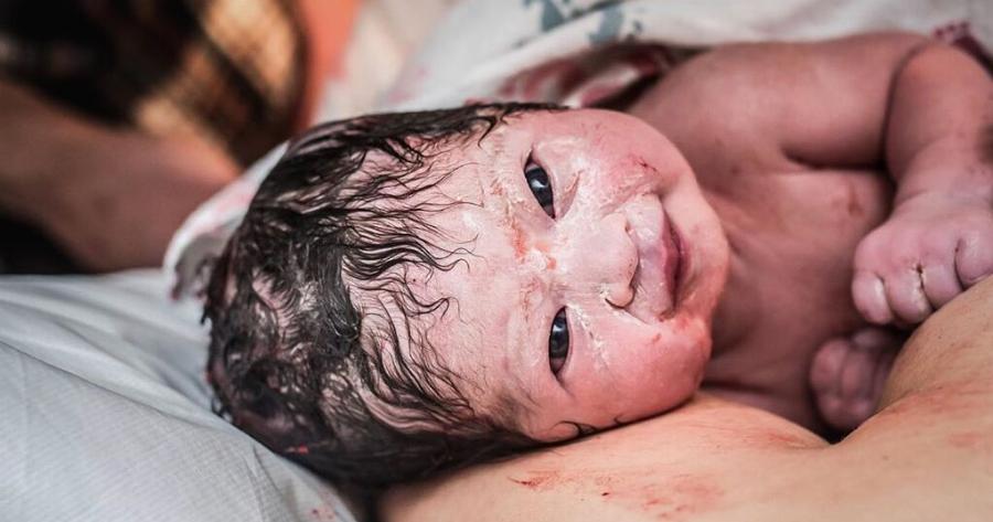 Μωρό γεννήθηκε γεμάτο μαλλιά και με μεγάλο χαμόγελο και οι φωτογραφίες του κάνουν το γύρο του διαδικτύου