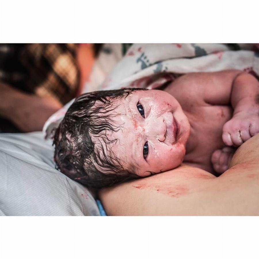 Μωρό γεννήθηκε γεμάτο μαλλιά και με μεγάλο χαμόγελο και οι φωτογραφίες του κάνουν το γύρο του διαδικτύου