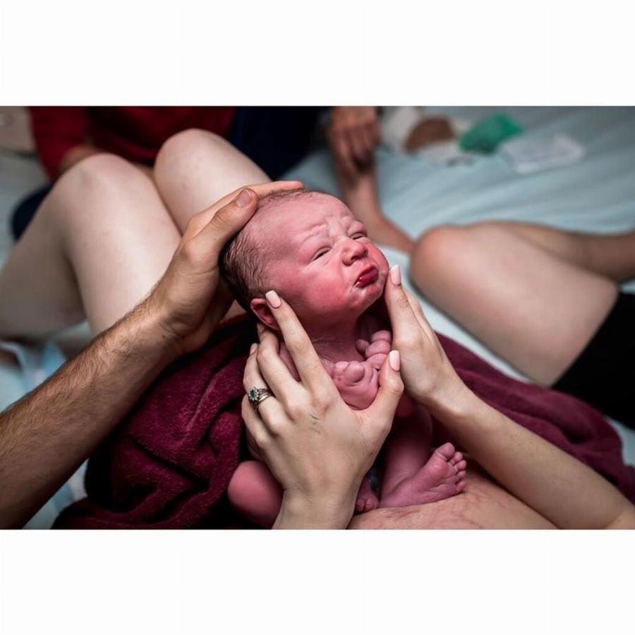 Μωρό γεννήθηκε γεμάτο μαλλιά και με μεγάλο χαμόγελο και οι φωτογραφίες του κάνουν το γύρο του διαδικτύου