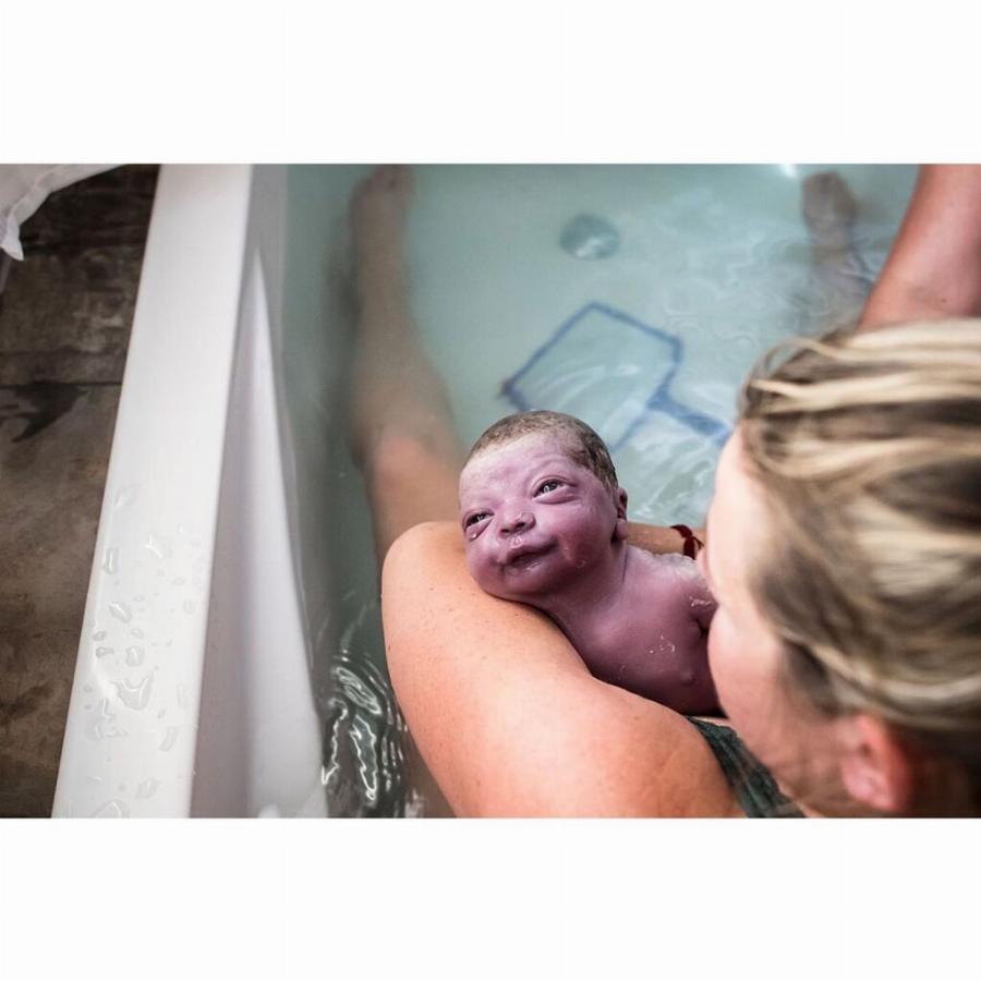 Μωρό γεννήθηκε γεμάτο μαλλιά και με μεγάλο χαμόγελο και οι φωτογραφίες του κάνουν το γύρο του διαδικτύου