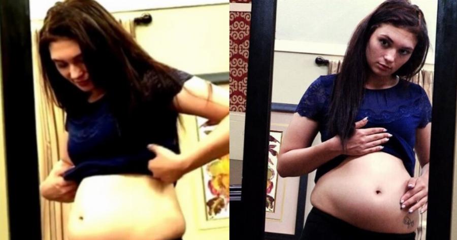 19χρονη λέει πως είναι έγκυος, φουσκώνει η κοιλιά της και οι γιατροί δεν βλέπουν μωρό: «Έχω μέσα μου τον Ιησού»