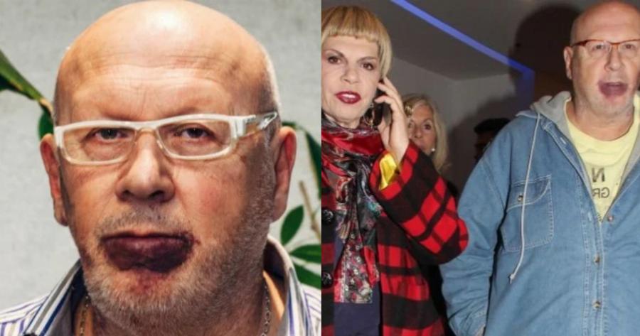 Λάκης Παπαδοπούλος: Ο Λάκης με τα ψηλά ρεβέρ, η μεγάλη καριέρα στη δισκογραφία, ο 23χρονος ζωγράφος γιος και το σημάδι στο πρόσωπο