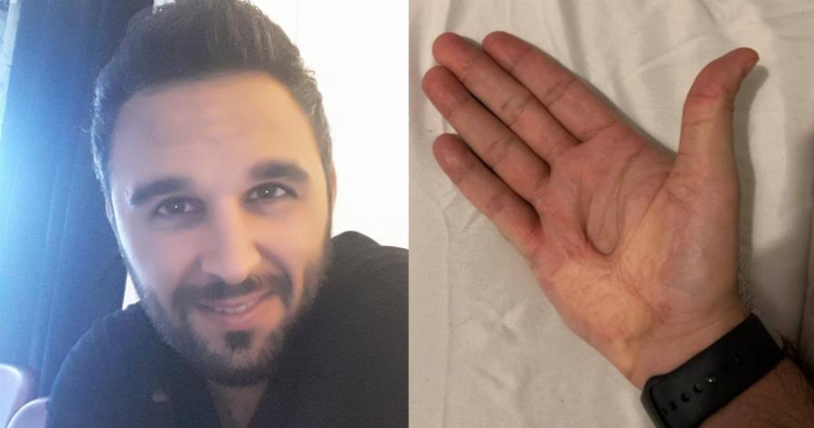 Χρήστος Χρυσάφης: Η πίστη στο Θεό, το συγκλονιστικό θαύμα και οι «πληγές του Εσταυρωμένου» στα χέρια του