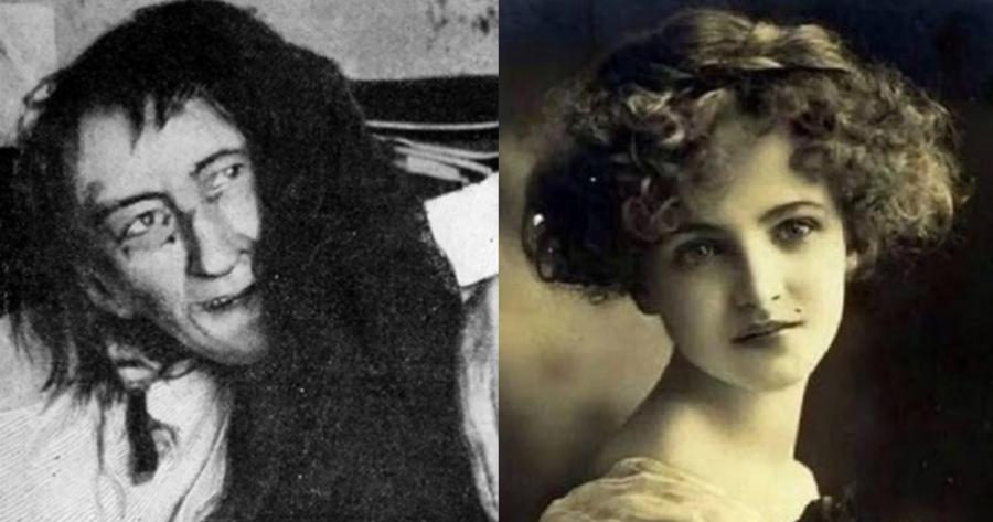 Την κλείδωσαν για 25 χρόνια στη σοφίτα: Η απάνθρωπη τιμωρία μιας μητέρας στην κόρη της,  γιατί ερωτεύτηκε τον λάθος άντρα