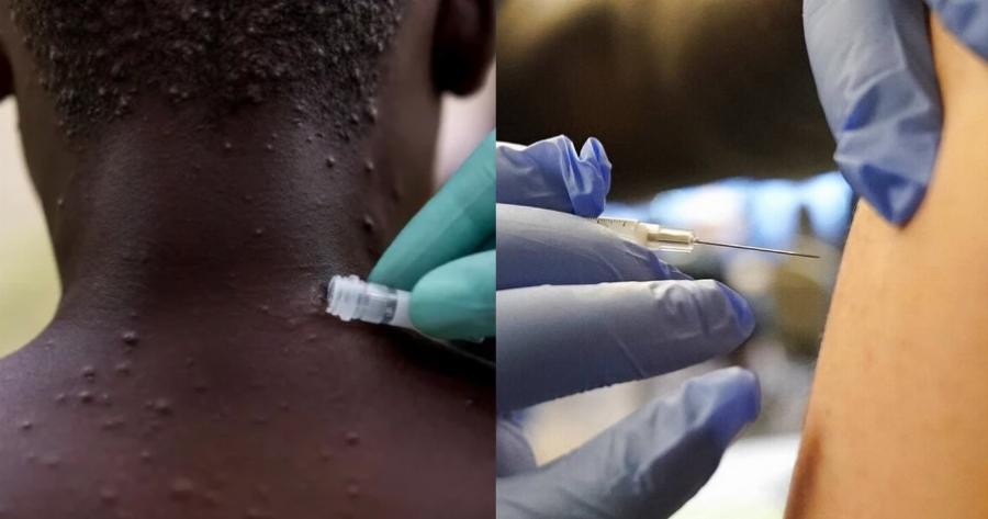 Τι αποφάσισε η Εθνική Επιτροπή Εμβολιασμών για την ευλογία των πιθήκων – Ποιοι θα εμβολιαστούν