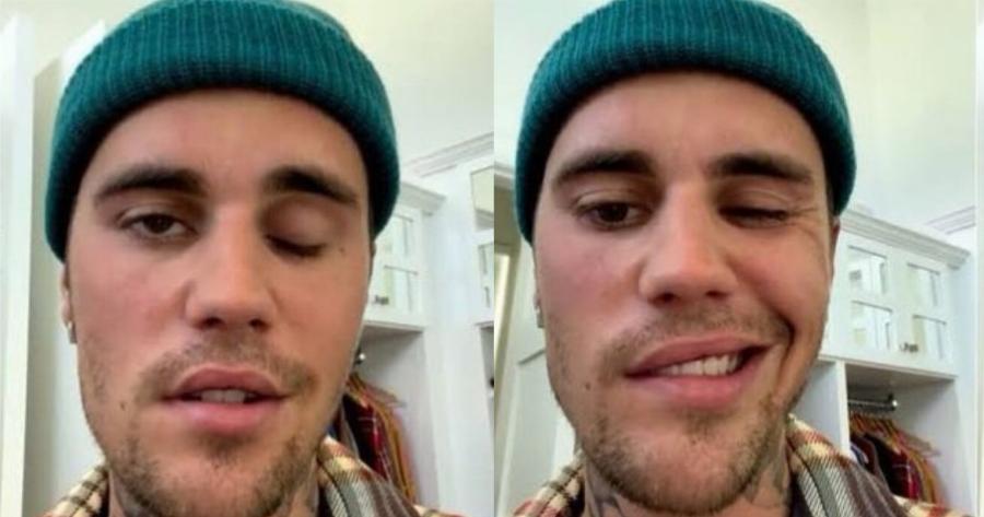 Τζάστιν Μπίμπερ: «Με τη βοήθεια του Ιησού αντιμετωπίζω την ασθένειά μου»