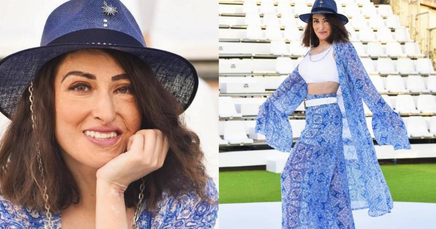 Δύναμη ψυχής από την Ιωάννα Παλιοσπύρου: Φωτογραφίζεται σε καλοκαιρινό mood και μάς δείχνει τα σημάδια στο σώμα της