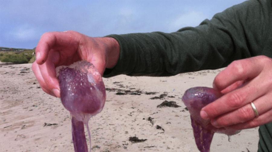 Αν σε τσιμπήσει Μωβ Μέδουσα γεμίζεις φουσκάλες που κρατάνε μέχρι και 6 μήνες – Οι πιο επικίνδυνες παραλίες