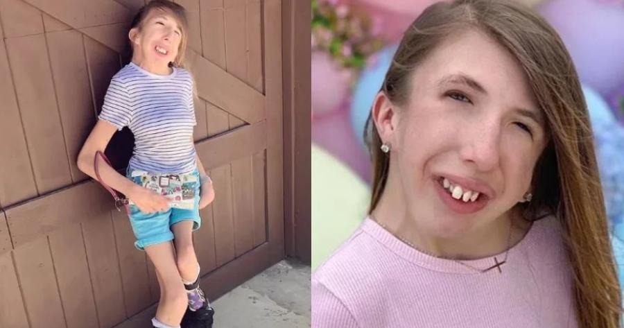 Μαχήτρια: H 14χρονη με σπάνια πάθηση έχει υπομείνει 33 χειρουργεία – Η ασφάλιση της δεν καλύπτει κανένα κόστος θεραπείας