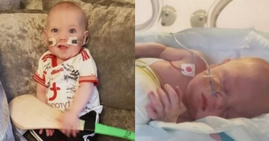 Αληθινή ιστορία: Μωράκι που δεν θα επιβίωνε στον τοκετό σήμερα είναι 10 μηνών και πάει σπίτι του για 1η φορά