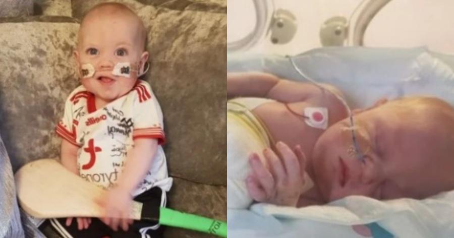 Αληθινή ιστορία: Μωράκι που δεν θα επιβίωνε στον τοκετό σήμερα είναι 10 μηνών και πάει σπίτι του για 1η φορά