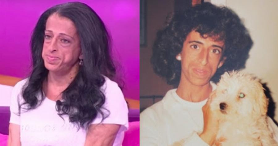 Μαρία Λοΐζου: «Με έλεγαν πίθηκο και με ρωτούσαν γιατί γεννήθηκα έτσι. Ηταν πολύς ο πόνος… Ήμουν 14 χρονών»