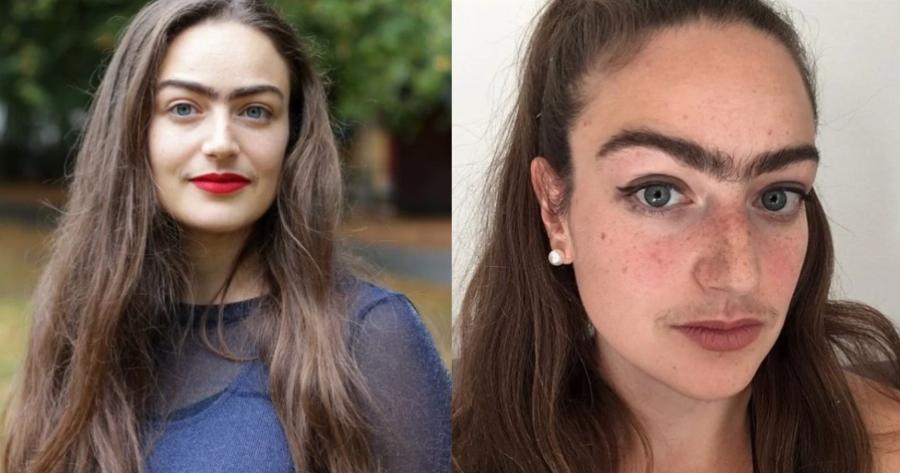 Κοπεγχάγη: Η 31χρονη που σταμάτησε να βγάζει φρύδια και μουστάκι γιατί νιώθει θηλυκή ακόμη και με τις τρίχες της