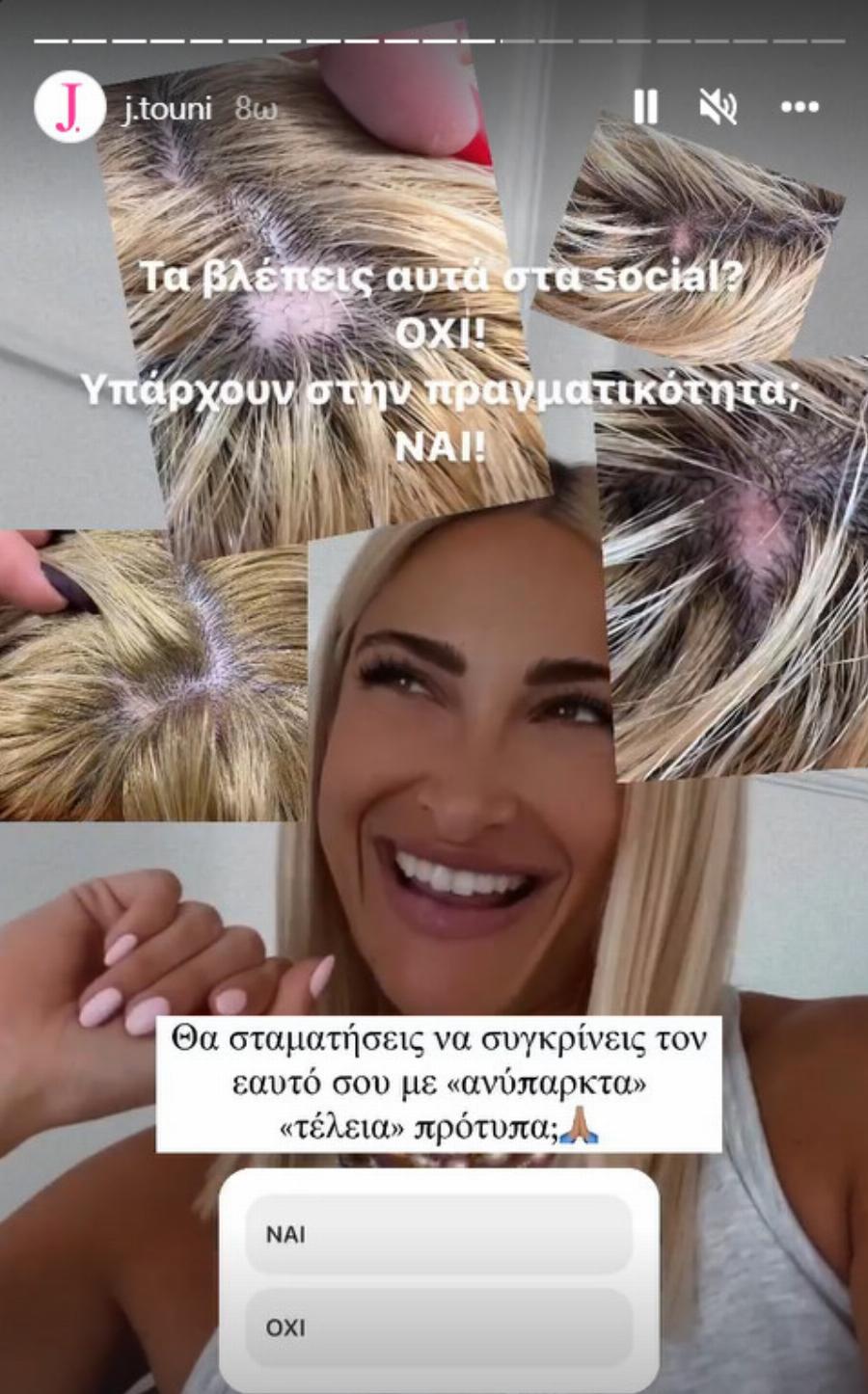 Η Ιωάννα Τούνη αποκάλυψε το πρόβλημα υγείας που την ταλαιπωρεί με μια φωτογραφία