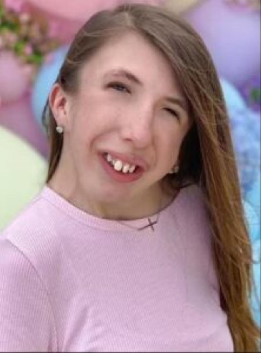 Μαχήτρια: H 14χρονη με σπάνια πάθηση έχει υπομείνει 33 χειρουργεία – Η ασφάλιση της δεν καλύπτει κανένα κόστος θεραπείας