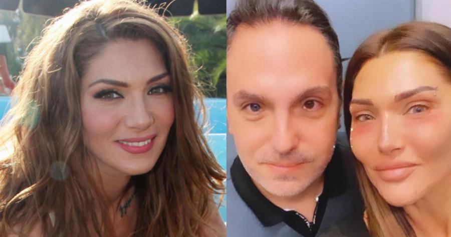 Αγγελική Ηλιάδη: Η ανάρτηση με τον γιατρό της, το προσβλητικό σχόλιο για παραμόρφωση στο πρόσωπό της και η αποστομωτική απάντηση