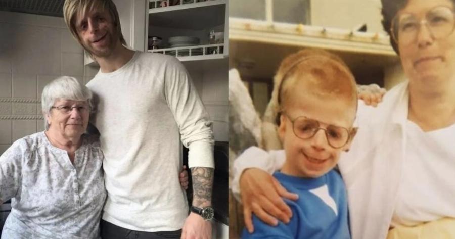 Αληθινή ιστορια: Η υπέροχη ιστορία του αγοριού με σύνδρομο TCS που εγκατέλειψαν οι γονείς του, αλλά τον διάλεξε η θετή μαμά του