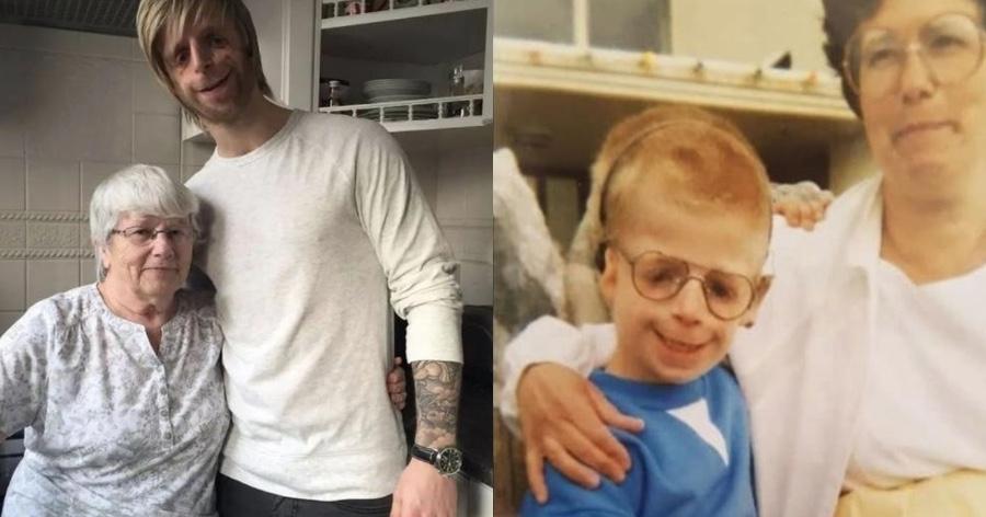 Αληθινή ιστορια: Η υπέροχη ιστορία του αγοριού με σύνδρομο TCS που εγκατέλειψαν οι γονείς του, αλλά τον διάλεξε η θετή μαμά του