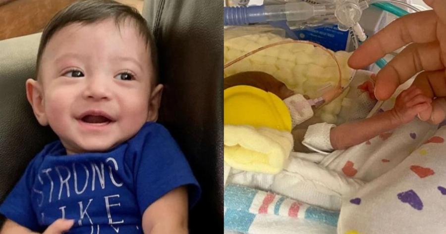 Προωράκι μωράκι που έζησε από θαύμα γιόρτασε τα πρώτα του γενέθλια