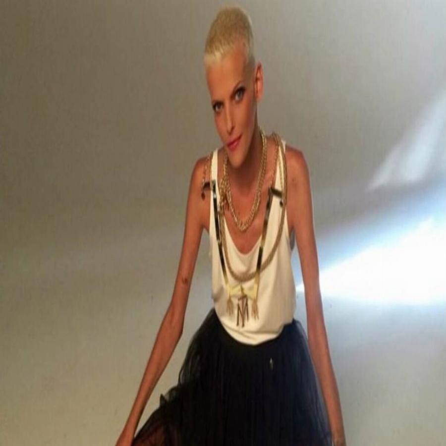 Νανά Καραγιάννη: Η μάχη με την νευρική ανορεξία, το δύσκολο διαζύγιο, το τραγικό τέλος και η κληρονομιά που άφησε στην φίλη της