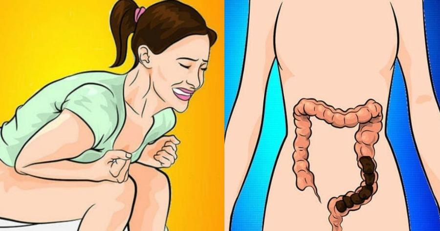 Εννιά υγιεινές τροφές που καθαρίζουν το παχύ έντερο με φυσικό τρόπο και βοηθούν στη σωστή λειτουργία του