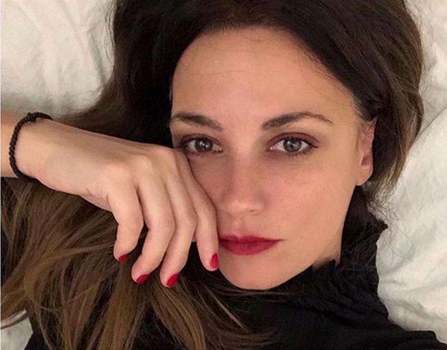 Σοφία Φαραζή: Τι είναι η ροδόχρους νόσος από την οποία πάσχει – Το αυτοάνοσο νόσημα που της άλλαξε τη ζωή