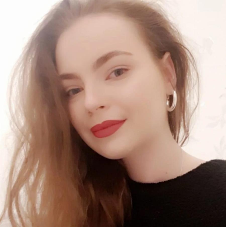 Ιρλανδία: Μαθήματα ζωής δίνει 24χρονη που υπέστη βαριά εγκαύματα εξαιτίας πυρκαγιάς