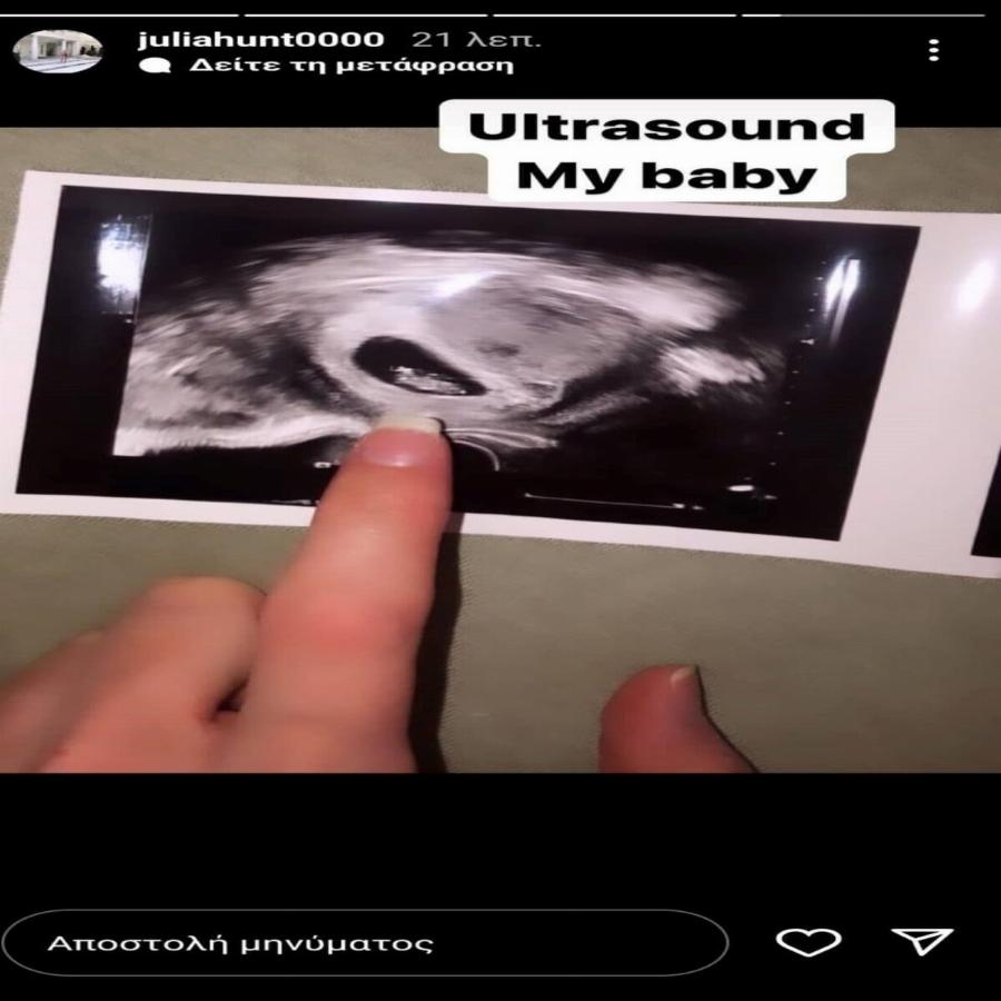 Συνεχίζει τις αναρτήσεις για την εγκυμοσύνη της η Τζούλια Αλεξανδράτου: Έδειξε στο Instagram το υπερηχογράφημα του μωρού