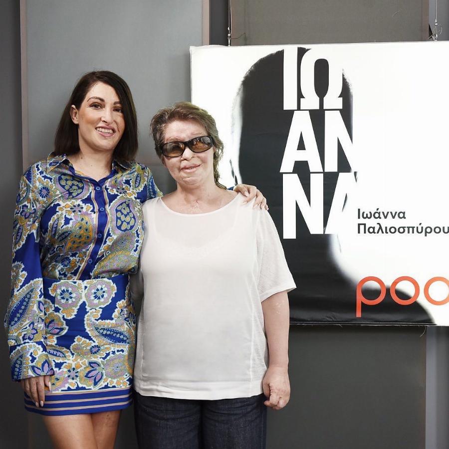 Συνάντηση κορυφής: Κωνσταντίνα Κούνεβα και  Ιωάννα Παλιοσπύρου – Οι δυο γυναίκες που δέχτηκαν επίθεση με βιτριόλι