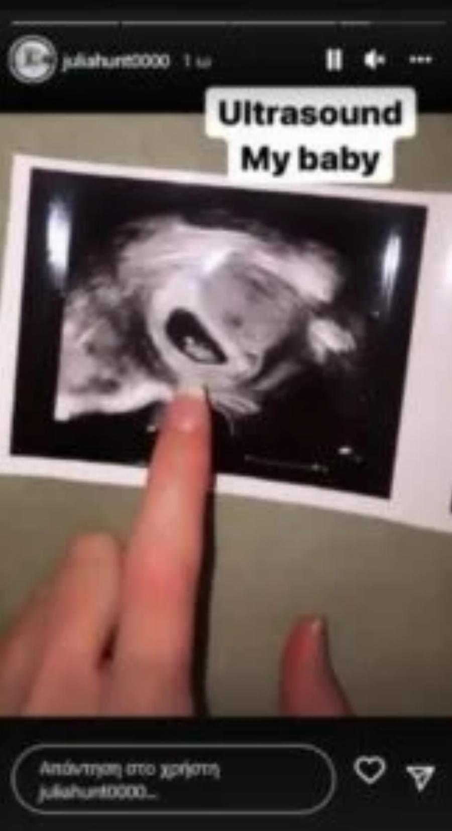 “Η εγκυμοσύνη δεν αντέχεται”: Η Τζούλια Αλεξανδράτου ποζάρει με μαγιό μετά την ανακοίνωση για την εγκυμοσύνη